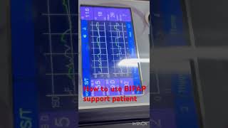 How to use bipap machine  BIPAP support icu patient  BIPAP setup icu patient  bipap shorts [upl. by Trenna]