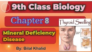 Mineral Deficiency Disease  Goiter amp Anemia  chapter 08  9th class Biology [upl. by Eirtemed]