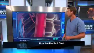 The Death of Lucille Ball Medical Course [upl. by Ahsikyt]