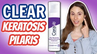 HOW TO CLEAR KERATOSIS PILARIS ON THE FACE DERMATOLOGIST DrDrayzday [upl. by Rue733]