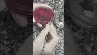 Sputum Culture Diagnosing Respiratory Infections  Lab Testing Guide labinsight lab shortvideo [upl. by Leda23]