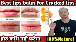 Best Lip Balm For Dry Cracked And Chapped Lips🤩 [upl. by Etnuaed]