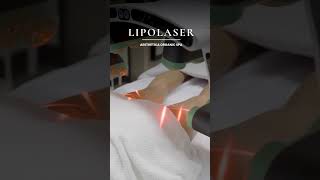 Lipolaser [upl. by Isdnyl]