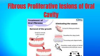 Lecture 5 Fibrous Proliferative lesions of Oral Cavity 🔥GI PathologyBest Medical Channel [upl. by Alilak]