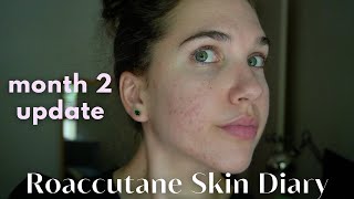 Roaccutane Daily Skin Diary  Month 2  The Purge Begins Low Dose [upl. by Ffoeg]