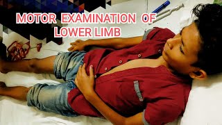 motor examination of lower limb paediatrics neurological examination lMN examinationpaediatrics [upl. by Steen]