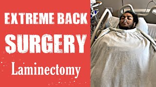 Laminectomy Decompression Surgery [upl. by Hajan721]