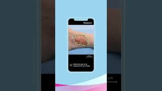 Cutimed Wound Navigator Your smart app for individual wound care English [upl. by Serrell700]