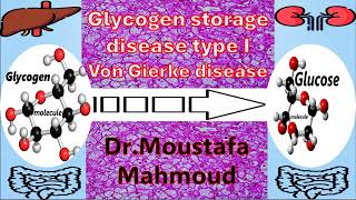 GLYCOGEN STORAGE DISEASE TYPE I OR VON GIERKE DISEASE [upl. by Kaiser501]