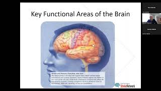 Stroke 101  Neuroanatomy amp Stroke Syndromes Review Apr 26 2023 [upl. by Fortunia]