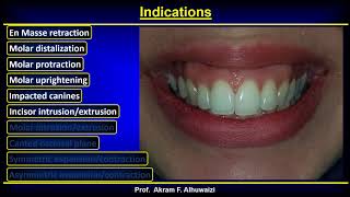 TADs 2018 Part 4 Indications English [upl. by Naicul13]