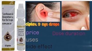 ciplox D eyes and ear drops ka istemal [upl. by Eniamurt]