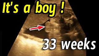 Baby boy in ultrasound [upl. by Brower191]