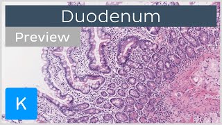 Duodenum histology slide tissues and cells preview  Human Histology  Kenhub [upl. by Coit]