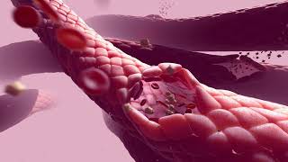 Random42 Science in Motion  Blood Clotting [upl. by Alakim]