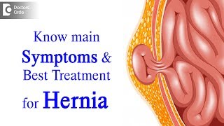 What is Hernia Symptoms Causes Types Treatment  Dr Harish N S  Doctors Circle [upl. by Nawd]