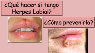 HERPES Recomendaciones en caso de Herpes labial [upl. by Tuinenga]