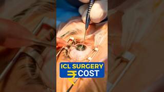 What Is ICL Surgery Cost [upl. by Cathrine]