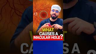 What causes a Macular Hole [upl. by Niemad225]