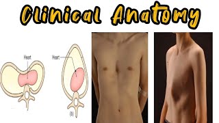 Thoracic Wall amp Thoracic Cage Anatomy Bangla  Clinical Anatomy  Thorax [upl. by Lletnwahs]