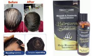 Trichocare Hairstorm Solution Minoxidil amp Finasteride Topical Solution [upl. by Adekram518]