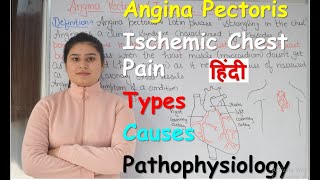 Angina Pectoris in Hindi  Ischemic Chest Pain  Types of Angina  Causes  Pathophysiology  Part 1 [upl. by Alaekim]