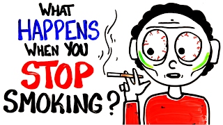 What Happens When You Stop Smoking [upl. by Iniretake942]