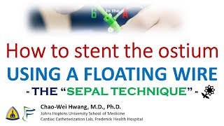 Floating Wire Stenting of AortoOstial Lesions quotSepal Techniquequot [upl. by Anerbes]