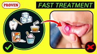 10 Fast Mouth Ulcer Remedies at Home [upl. by Jochbed254]