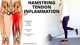 Hamstring Tendinopathy Best Relief Exercises Causes and How to Heal Tendinitis [upl. by Eanom]