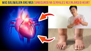 TOP 5 SINTOMAS ng ENLARGED HEART [upl. by Ethyl]