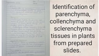 Identification of parenchyma collenchyma and sclerenchyma tissues in plants from prepared slides [upl. by Ferri]