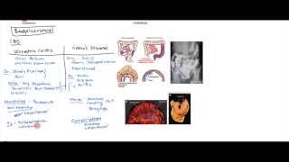 Inflammatory Bowel Disease Crohns and Ulcerative Colitis for USMLE Step 1 [upl. by Kimball]