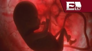 ¿Qué riesgos implica un aborto clandestino  Salud con Gloria Contreras [upl. by Eselehs554]