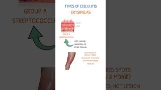 CELLULITIS ERYSIPELAS [upl. by Alphonsine]