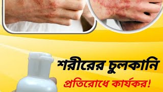 শরীরের চুলকানি প্রতিরোধে কার্যকরElimate Plus Lotion [upl. by Daffi]