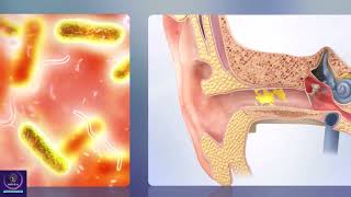 Ear Wax Removal Short Explanation [upl. by Sorenson557]