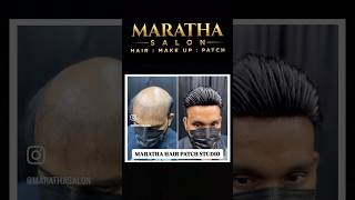 Non  Surgical Treatment Men’s Hair Patch hairpatch hairwig mumbai viralvideo mumbaihairstylist [upl. by Oner]