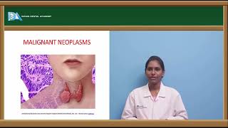 Tumors of thyroid gland  General surgery for Dentists  NEETMDSBDSNBDEOREDDS [upl. by Idok]