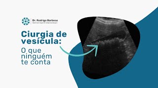 Cirurgia na Vesícula O Que Ninguém Te Contou Dr Rodrigo Barbosa [upl. by Luemas527]