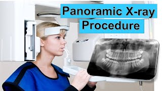 Panoramic Dental XRay Procedure EXPLAINED  PANORAMIC XRAY  Panoramic radiography OPG [upl. by Wey]