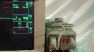 GE Marquette Solar 8000 Patient Monitor [upl. by Onek]