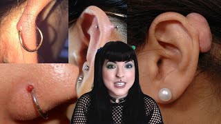 What Are Those Bumps On Your Piercings amp How to Get Rid Of Them  Piercer Explains [upl. by Amaras]