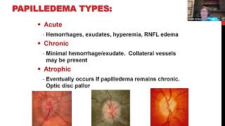 Clinical Grand Rounds in Optic Neuropathies Youve Got Some Nerve [upl. by Janet41]