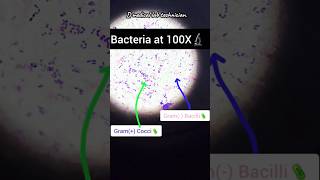 Gram positive amp Gram positive bacteria  Gram stain  bacteria shorts viralshorts lab bacteria [upl. by Elletnuahs]