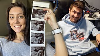 SURPRISING MY HUSBAND THAT IM PREGNANT [upl. by Adrell]