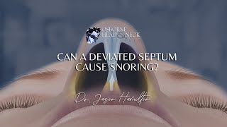 Can a deviated septum cause snoring [upl. by Helfant]