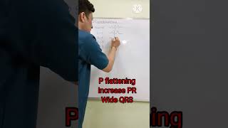 ECG changes in hyperkalemia [upl. by Tegdirb]