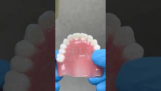 Maxillary Process Denture lsk121shorts dentist [upl. by Randie]