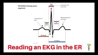 How to quickly read an EKG in the emergency department [upl. by Dixil]